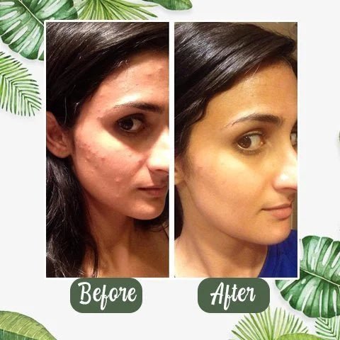 Clean Skin Co. Poreless Deep Cleanse Mask Stick Product | UzoShop