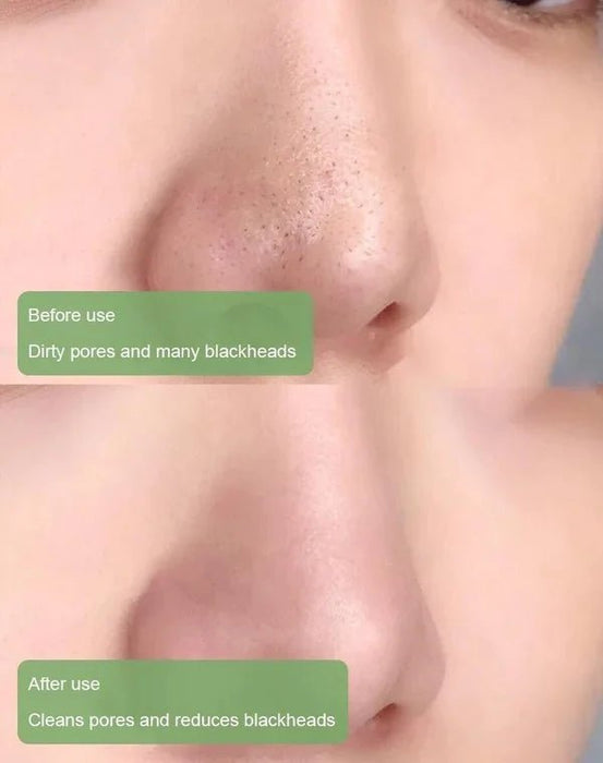 Clean Skin Co. Poreless Deep Cleanse Mask Stick Product | UzoShop