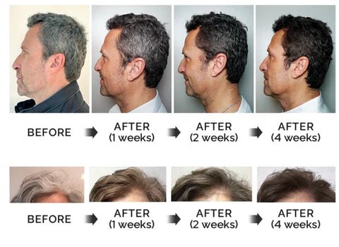 GrayLess Anti-Greying Hair Serum Product | UzoShop